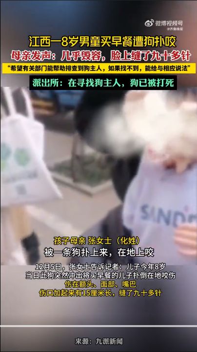 江西8岁男童遭狗扑咬:几乎毁容,脸上缝了九十多针 江西8岁男童遭狗扑咬:几乎毁容,脸上缝了九十多针