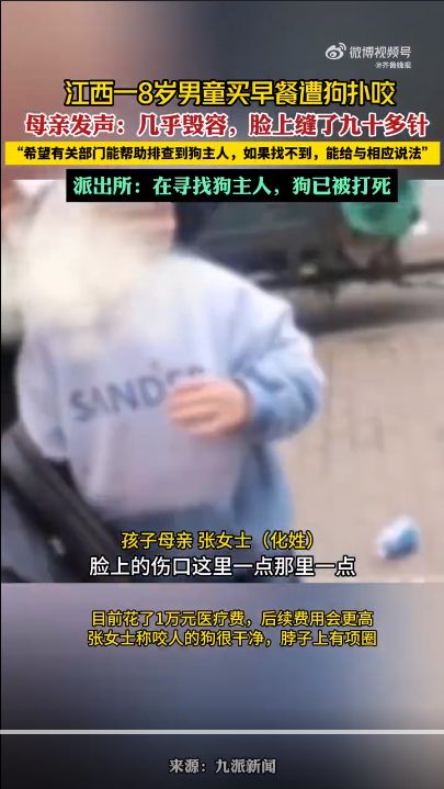 江西8岁男童遭狗扑咬:几乎毁容,脸上缝了九十多针 江西8岁男童遭狗扑咬:几乎毁容,脸上缝了九十多针