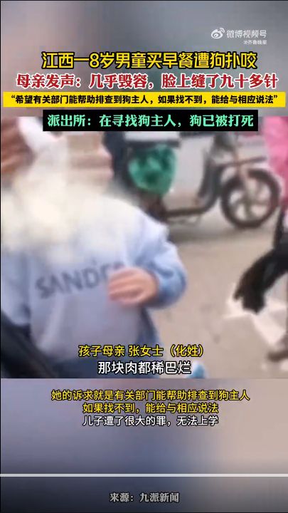 江西8岁男童遭狗扑咬:几乎毁容,脸上缝了九十多针 江西8岁男童遭狗扑咬:几乎毁容,脸上缝了九十多针