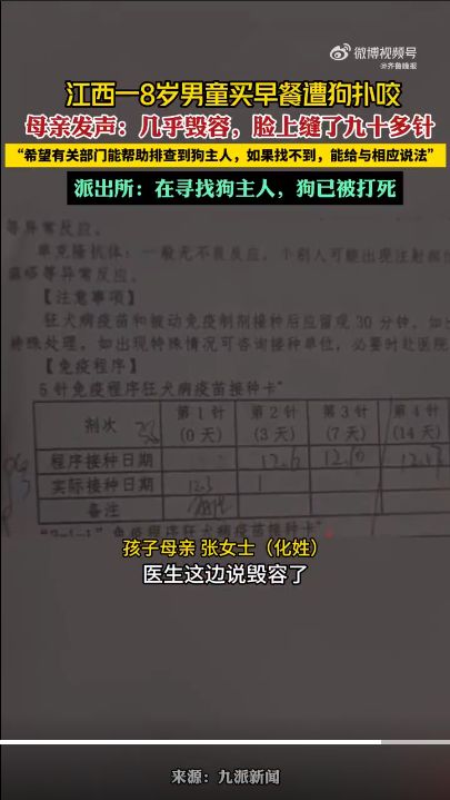 江西8岁男童遭狗扑咬:几乎毁容,脸上缝了九十多针 江西8岁男童遭狗扑咬:几乎毁容,脸上缝了九十多针